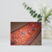 Mikroskopische Darstellung einer Blutinfektion Postkarte (Stehend Vorderseite)