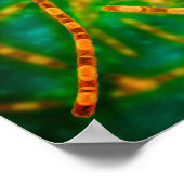 Mikroskopische Darstellung von Anthrax 2 Poster (Ecke)