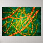 Mikroskopische Darstellung von Anthrax 2 Poster (Vorne)