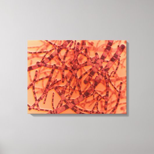 Mikroskopische Darstellung von Anthrax 3 Leinwanddruck (Vorderseite)