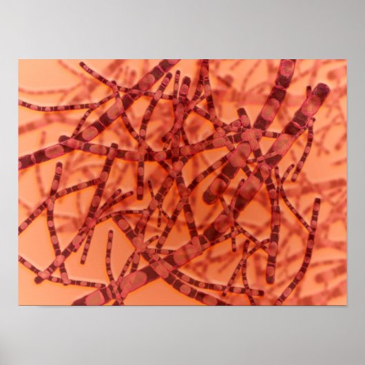 Mikroskopische Darstellung von Anthrax 3 Poster (Vorne)