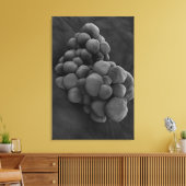 Mikroskopische Darstellung von Tumor 1 Leinwanddruck (Insitu (Wohnzimmer))