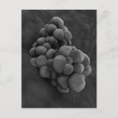 Mikroskopische Darstellung von Tumor 1 Postkarte (Vorderseite)