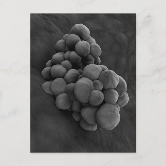 Mikroskopische Darstellung von Tumor 1 Postkarte (Vorderseite)