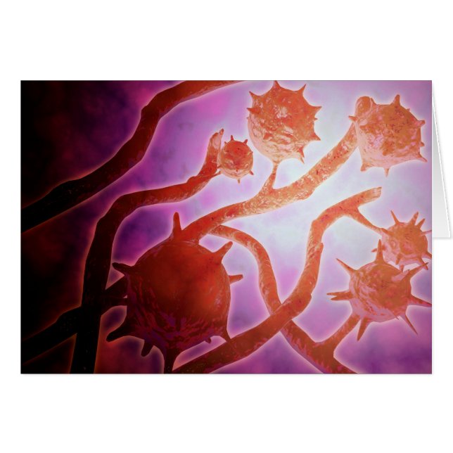 Mikroskopische Histoplasmose (Vorderseite (Horizontal))