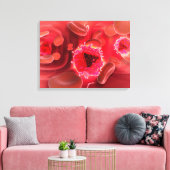 Mikroskopische Sicht auf das HIV-Virus in der Lung Leinwanddruck (Insitu (Wohnzimmer))