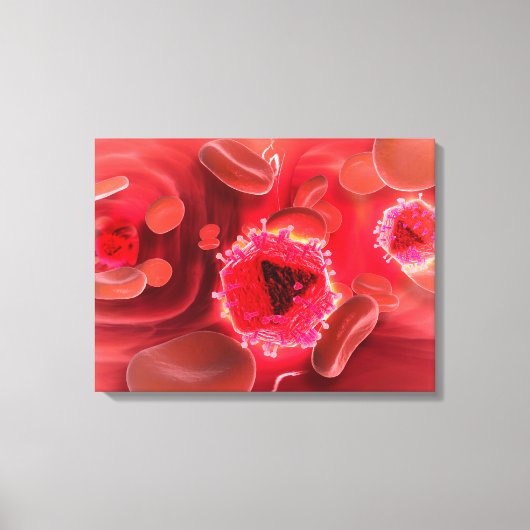 Mikroskopische Sicht auf das HIV-Virus in der Lung Leinwanddruck (Vorderseite)