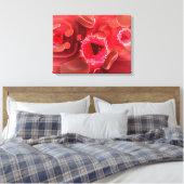 Mikroskopische Sicht auf das HIV-Virus in der Lung Leinwanddruck (Insitu (Schlafzimmer))