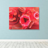 Mikroskopische Sicht auf das HIV-Virus in der Lung Leinwanddruck (Insitu (Holzboden))