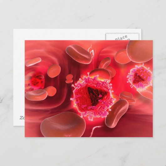 Mikroskopische Sicht auf das HIV-Virus in der Lung Postkarte (Vorne/Hinten)