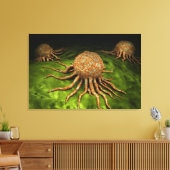 Mikroskopische Sicht auf das Krebsvirus Leinwanddruck (Insitu (Wohnzimmer))