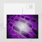 Mikroskopische Sicht der Bakterienpneumonie 2 Postkarte (Vorne/Hinten)