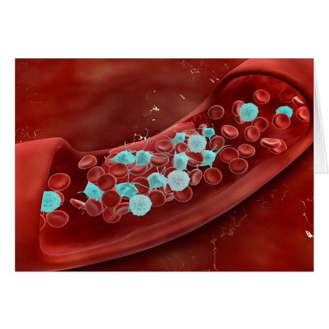 Mikroskopische Sicht der Blutgerinnung (Vorderseite (Horizontal))