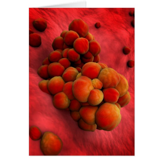 Mikroskopische Tumoransicht 2 (Vorne)