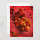 Mikroskopische Tumoransicht 2 Postkarte (Vorne/Hinten)