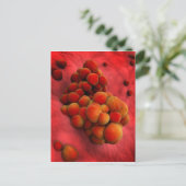 Mikroskopische Tumoransicht 2 Postkarte (Stehend Vorderseite)