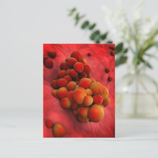 Mikroskopische Tumoransicht 2 Postkarte (Stehend Vorderseite)