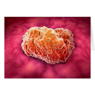 Mikroskopische Tumoransicht 3