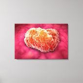 Mikroskopische Tumoransicht 3 Leinwanddruck (Vorderseite)