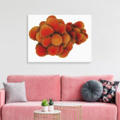 Mikroskopische Tumoransicht 4 Leinwanddruck (Insitu (Wohnzimmer))