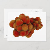 Mikroskopische Tumoransicht 4 Postkarte (Vorne/Hinten)