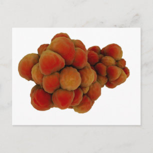 Mikroskopische Tumoransicht 4 Postkarte