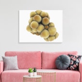 Mikroskopische Tumoransicht 5 Leinwanddruck (Insitu (Wohnzimmer))