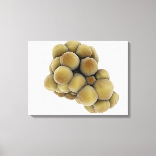 Mikroskopische Tumoransicht 5 Leinwanddruck (Vorderseite)