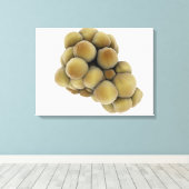 Mikroskopische Tumoransicht 5 Leinwanddruck (Insitu (Holzboden))