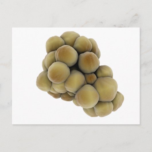 Mikroskopische Tumoransicht 5 Postkarte (Vorderseite)