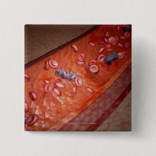 Mikroskopische Wiedergabe einer Blutinfektion Button