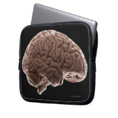 Modell des menschlichen Gehirns, Studio-Aufnahme Laptopschutzhülle (Vorderseite Links)