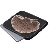 Modell des menschlichen Gehirns, Studio-Aufnahme Laptopschutzhülle (Vorne Knopf)