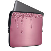 Modern Gold Ombre Marble Glam Metallfolie Laptopschutzhülle (Vorne Rechts)