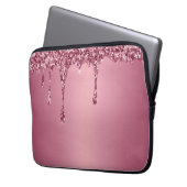 Modern Gold Ombre Marble Glam Metallfolie Laptopschutzhülle (Vorderseite Links)