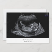 Moderne Minimalistische Sonogram Foto Babydusche Einladung (Rückseite)