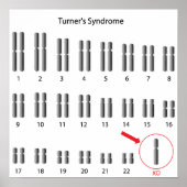 Monosomy X, Turner-Syndrom Poster (Vorne)