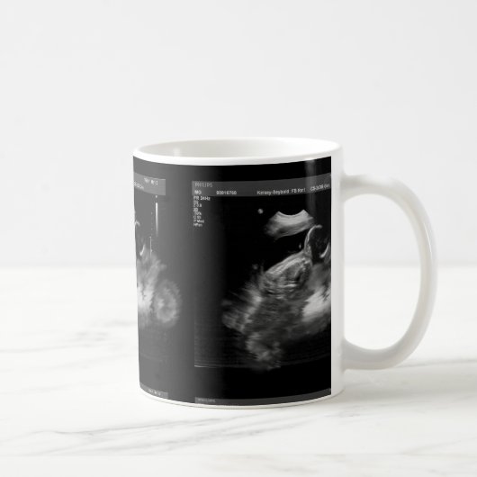 Motorradsonogram-Tasse Kaffeetasse (Rechts)