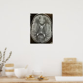 MRI Brain Poster (Küche)