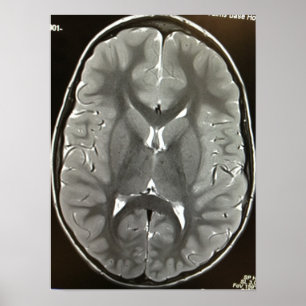 MRI Brain Poster