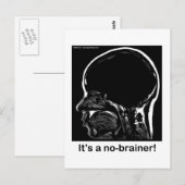 MRI: Das ist ein Selbstgänger! Postkarte (Vorne/Hinten)