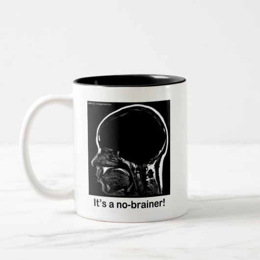 MRI: Das ist ein Selbstgänger! Zweifarbige Tasse (Links)