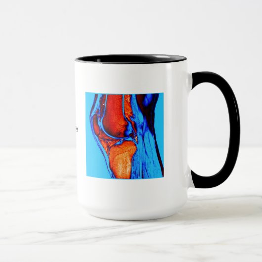 MRI des Knies Tasse (Rechts)