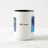 MRI des Knies Tasse (Zentrum)