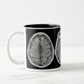 MRI Gehirn-Bild-Tasse Zweifarbige Tasse (Links)