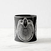 MRI Gehirn-Bild-Tasse Zweifarbige Tasse (Mittel)