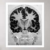 MRI Head Poster (Vorne)