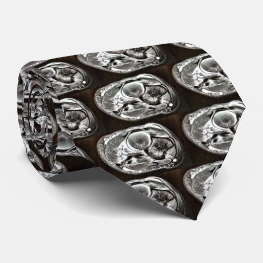 MRI KRAWATTE (Gerollt)