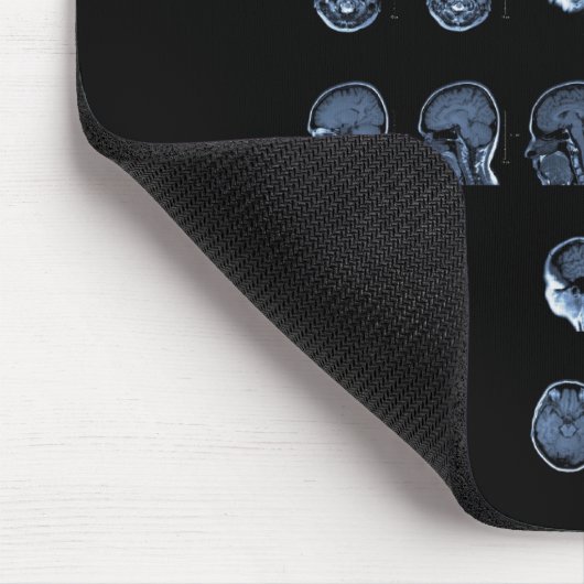 MRI Kreuz Mousepad (Ecke)
