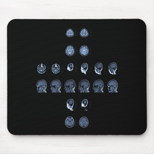 MRI Kreuz Mousepad (Vorne)